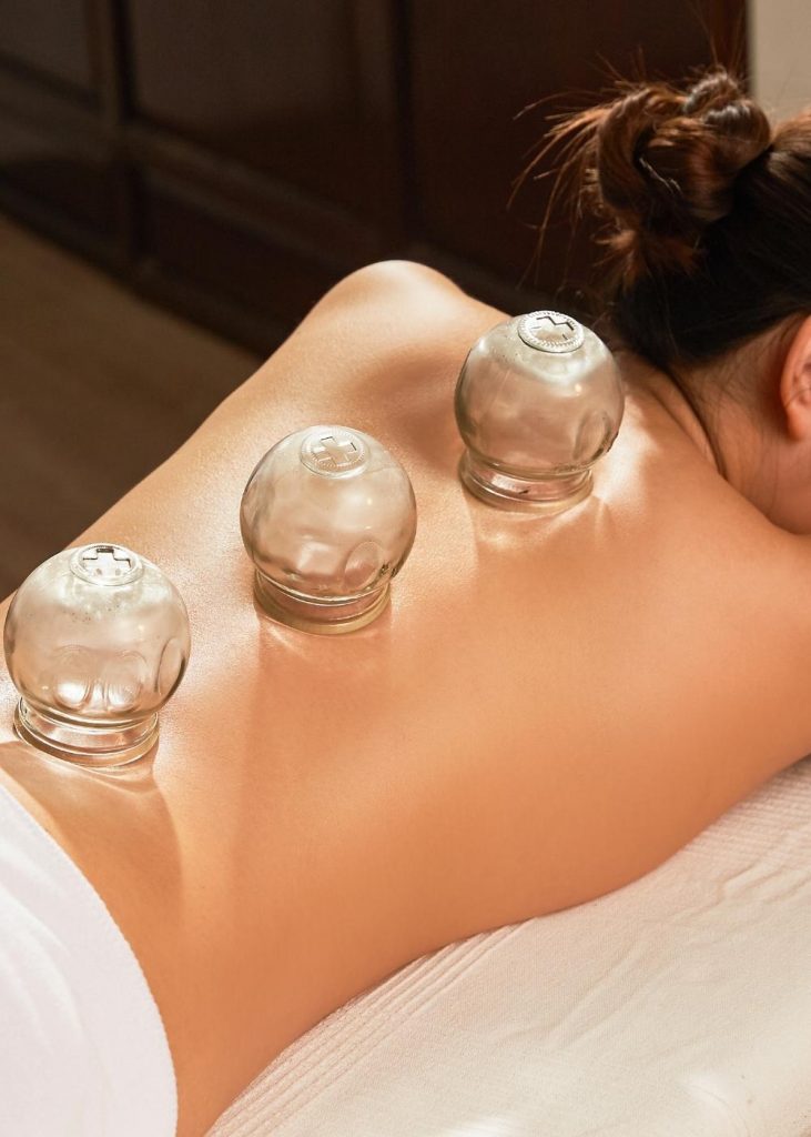 South Yarra Cupping Therapist